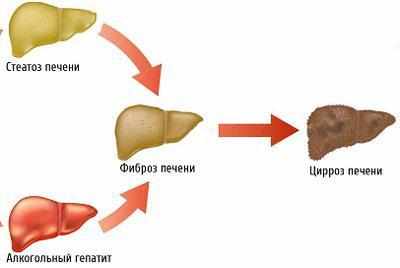Болезни печени