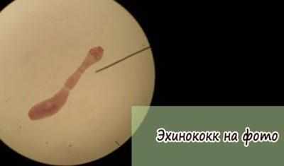 Эхинококк под микроскопом
