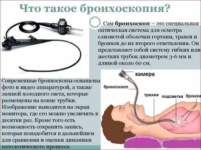 Что такое бронхоскопия
