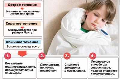 Симптомы туберкулеза у ребенка