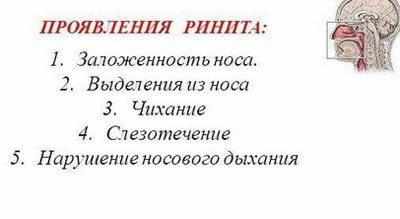 Симптомы ринита