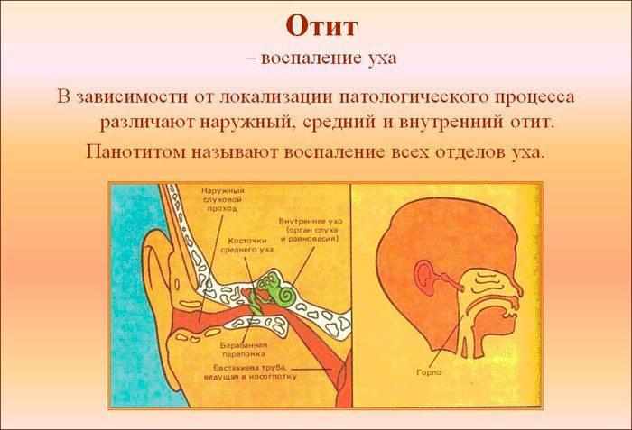 Отит