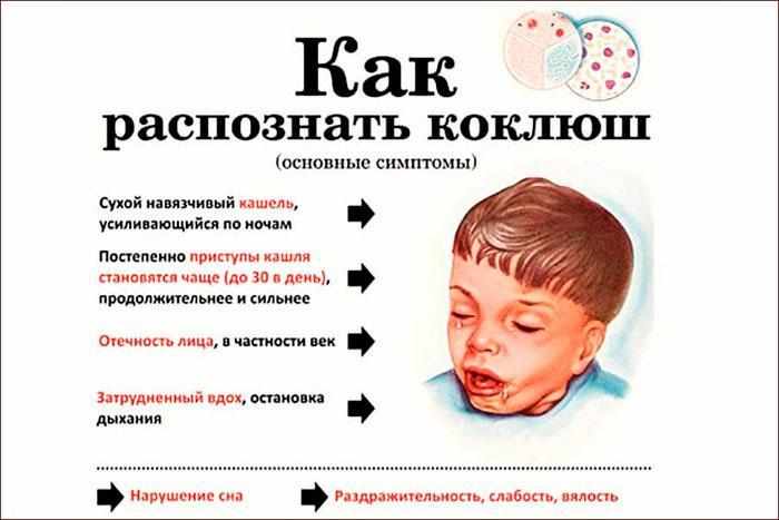 Симптомы коклюша