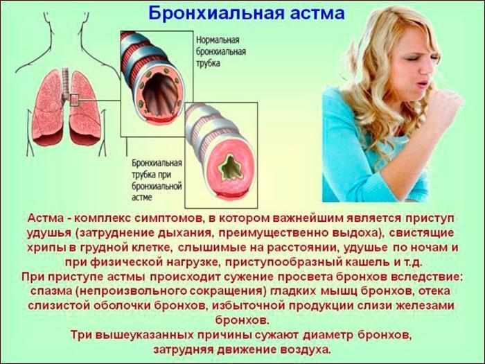 бронхиальная астма, симптомы