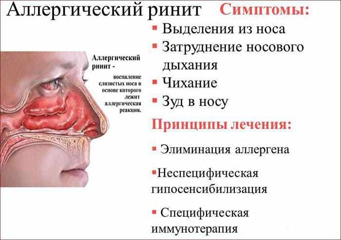 Симптомы и лечение аллергического насморка