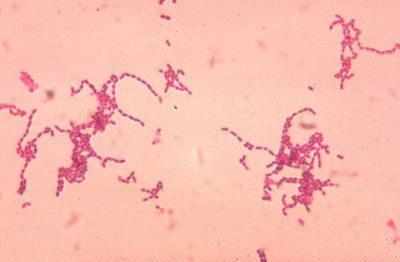 Возбудитель инфекции peptostreptococcus