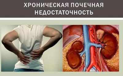 Почечная недостаточность
