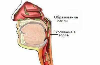 Затекание слизи в горло