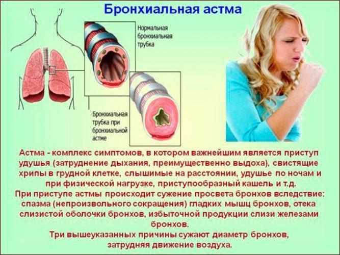 бронхиальная астма, симптомы