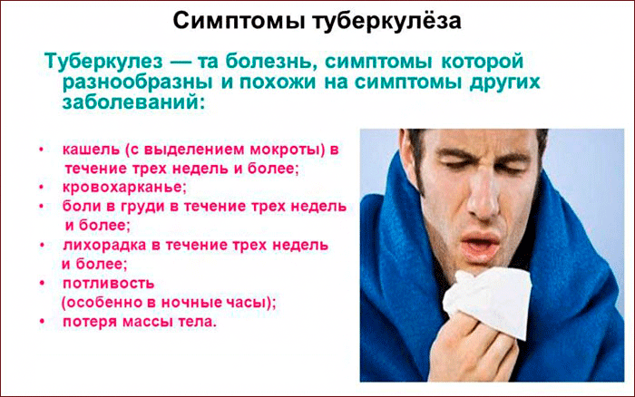 симптомы туберкулеза