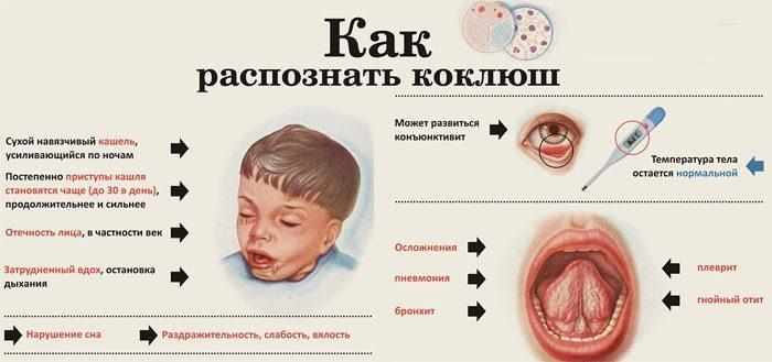Симптомы коклюша