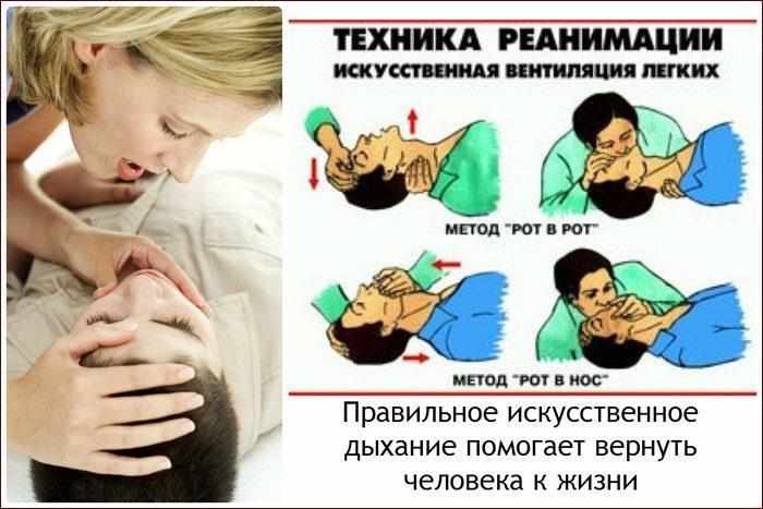 Вдувание воздуха в рот или в нос