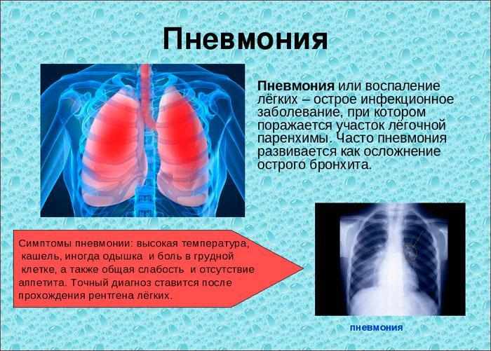 Симптомы пневмонии