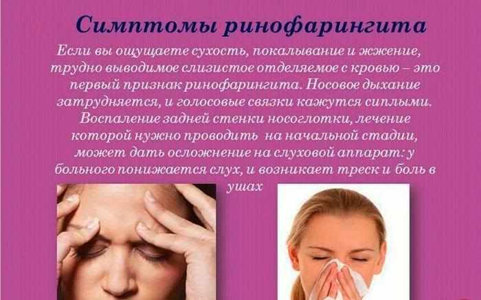 Симптомы ринофарингита