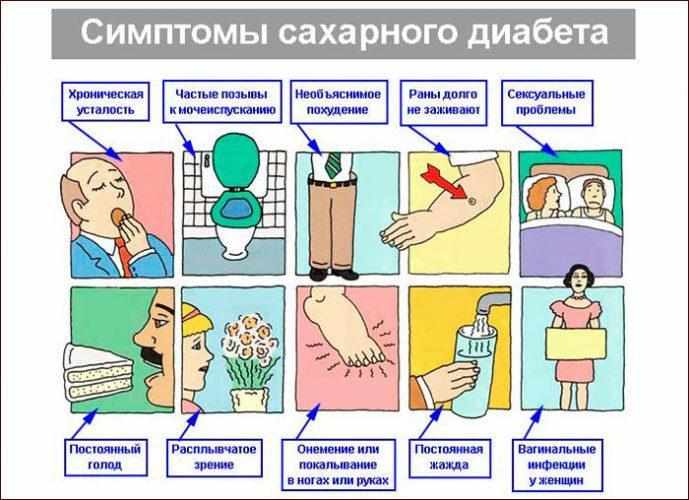 Симптомы сахарного диабета