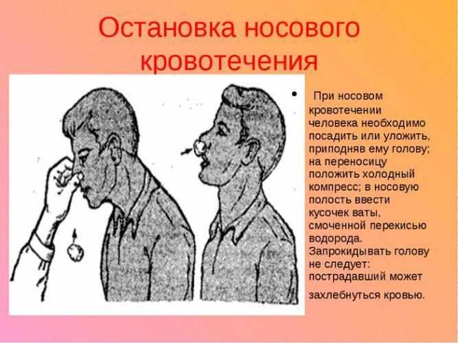 Первая помощь при переломе носа и кровотечении