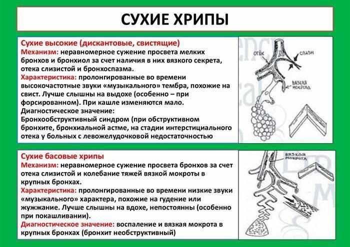сухие хрипы