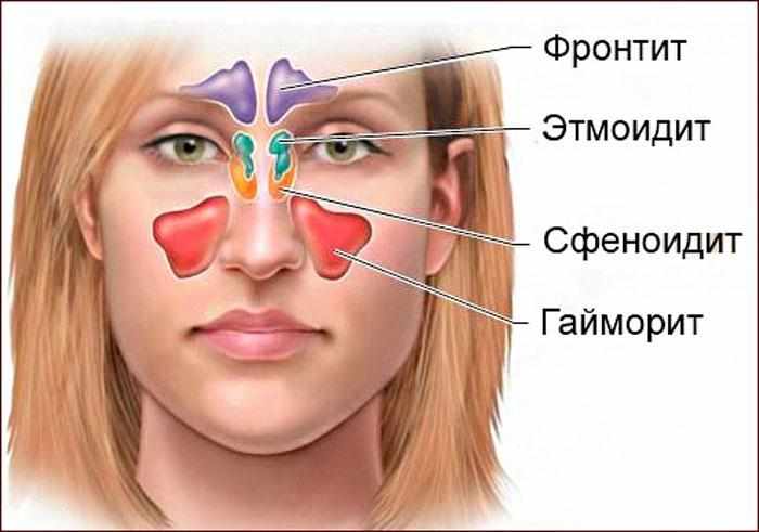 Расположение синуситов
