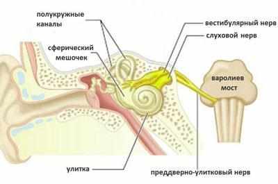 Неврит слухового нерва