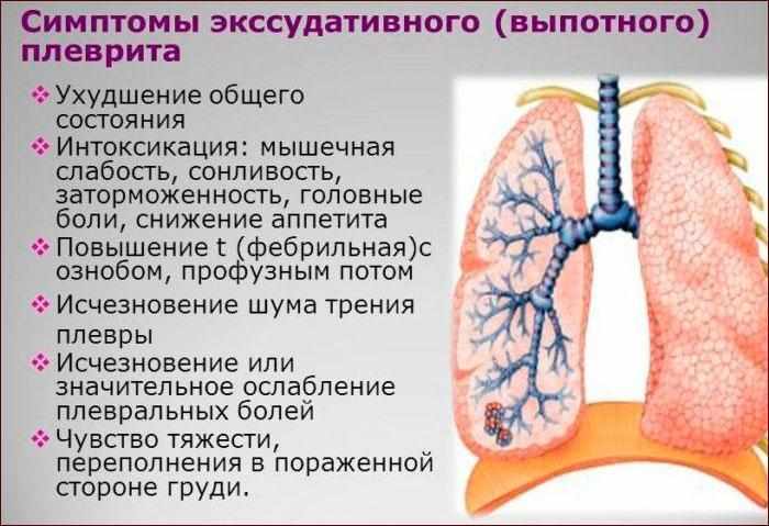Симптомы плеврита