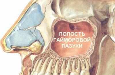 Полость гайморовой пазухи