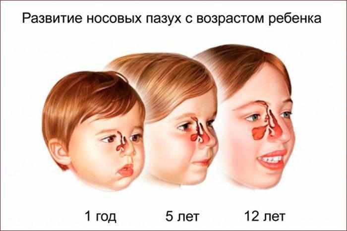 Развитие гайморовых пазух с возрастом ребёнка