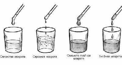 Виды мокроты