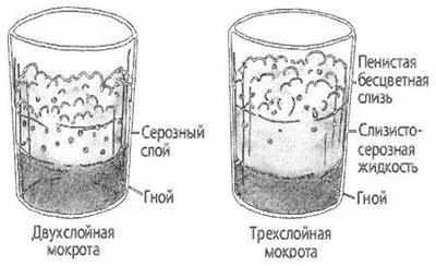 Анализ мокроты