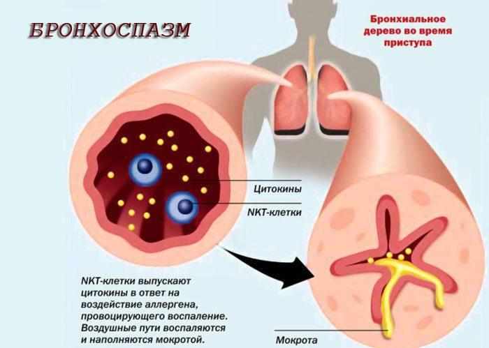 Бронхи при спазме