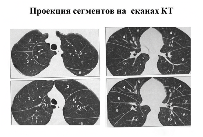 Сегменты легких на схеме