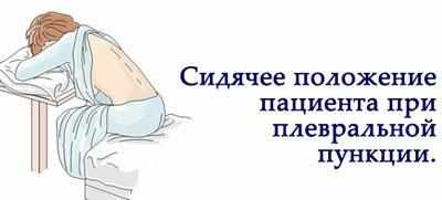Положение больного при пункции