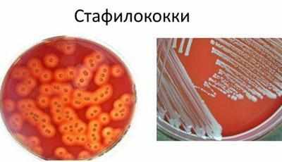 Стафилококки на бакпосеве