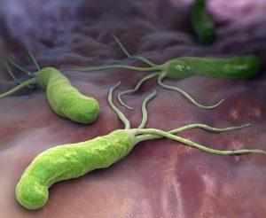 Helicobacter pylori
