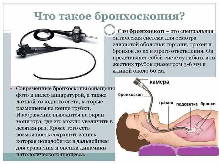 Что такое бронхоскопия