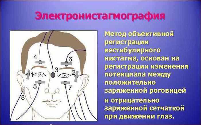 Что такое электронистагмография