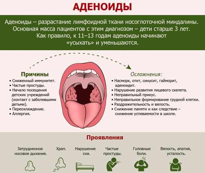 причины аденоидита