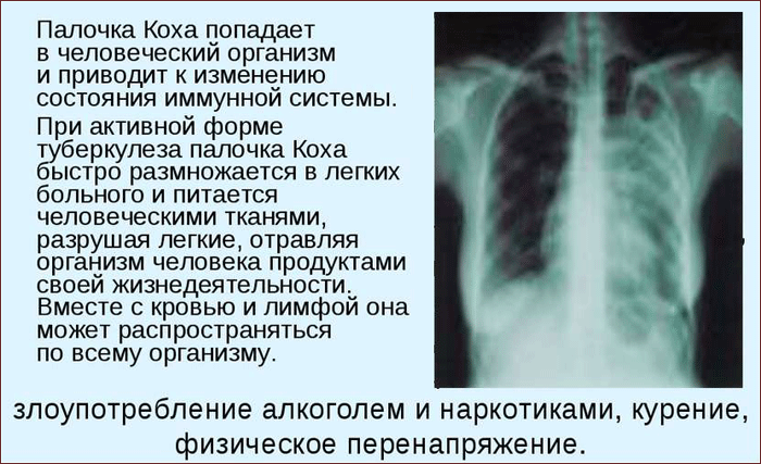 Механизм влияния палочки Коха на организм человека