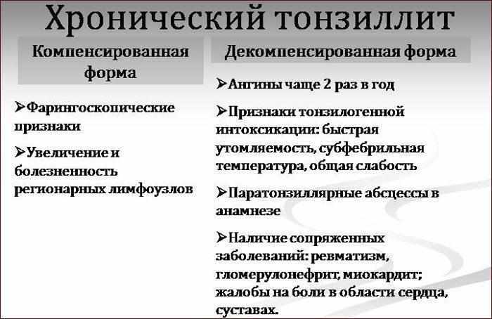 Формы тонзиллита