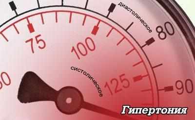 Повышенное давление