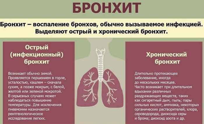 Симптомы бронхита