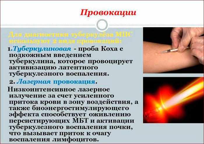 проба Коха