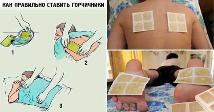 Как правильно ставить горчичники