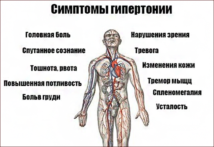 Гипертония клиническая картина