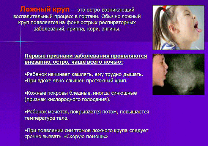 симптомы при ложном крупе