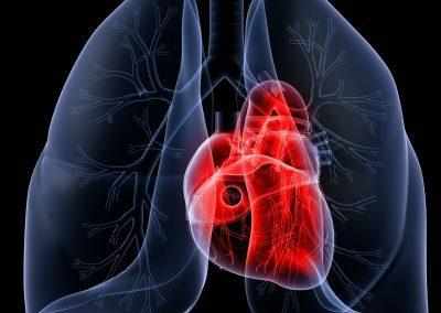 Человеческое сердце на рентгене
