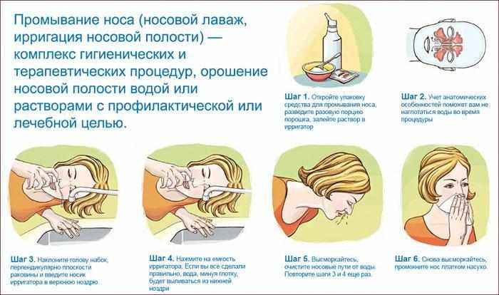 Как промывать нос