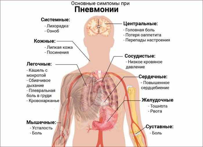 Основные симптомы при пневмонии.
