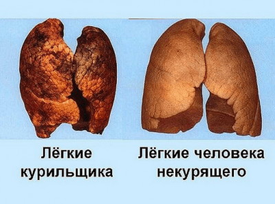 Легкие курящего и некурящего