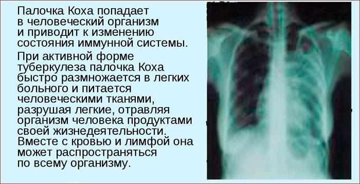 Палочка Коха