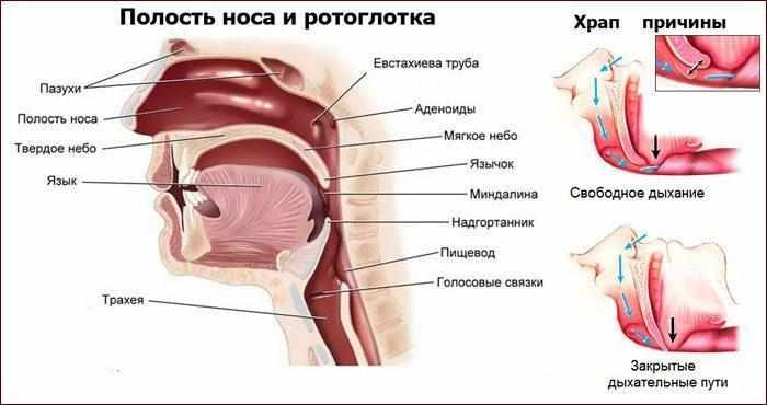 Причины храпа